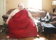 Doctors Remove Massive Fat From Woman s Stomach The Korea Times
