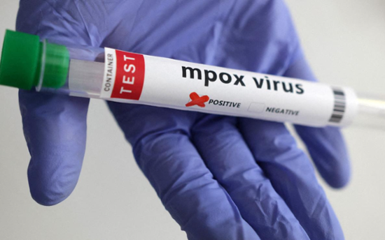 Britain identifies its first case of new mpox variant