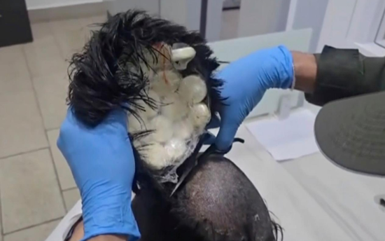 Colombian police catch man smuggling packets of cocaine under toupee
